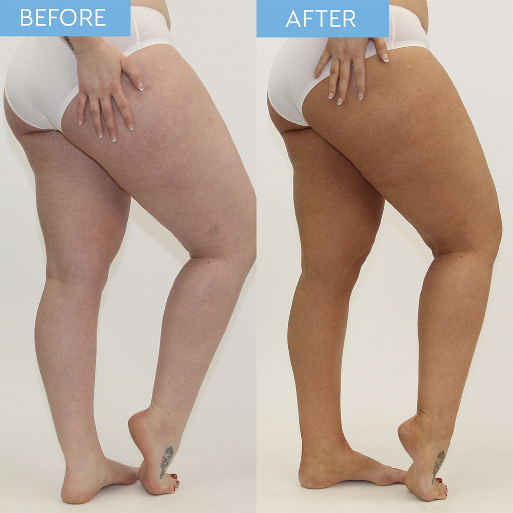 He-Shi H2O Glow - Clear Tanning Mousse 150ml - Medium-Dark Shade